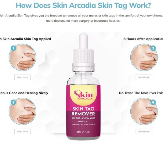 Skin Arcadia Skin Tag Remover
